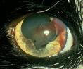 Haemorrhage in eye
